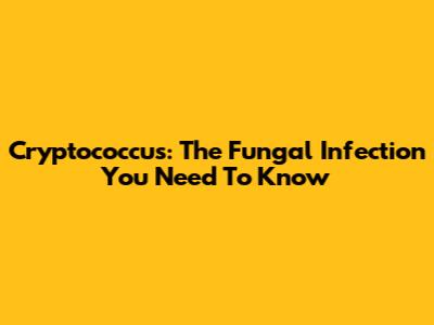 Cryptococcus: The Fungal Infection You Need To Know