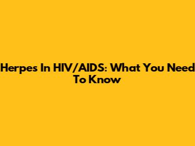 Herpes In HIV/AIDS: What You Need To Know
