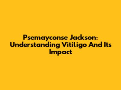Psemayconse Jackson: Understanding Vitiligo And Its Impact